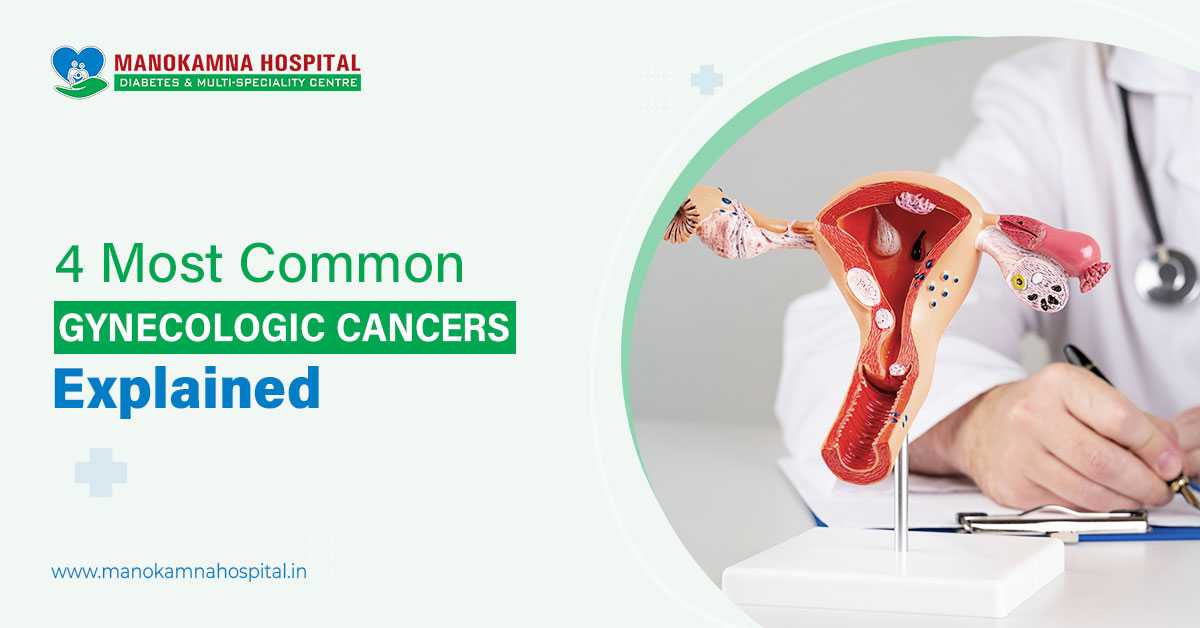 4 Most Common Gynecologic Cancers Explained